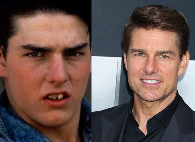 Tom Cruise